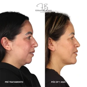dra-fernanda-boing-35