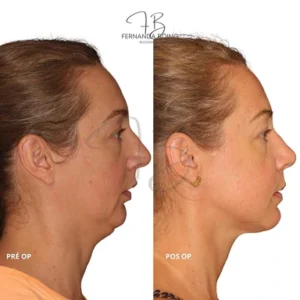 dra-fernanda-boing-39